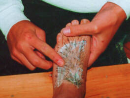 Pressing the gauze into the sticky latex